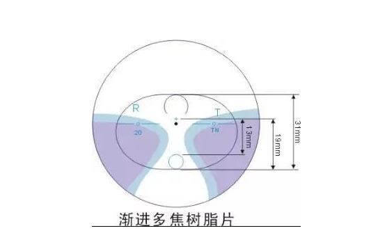 美麗島漸進(jìn)多焦鏡適合的人群，需要注意的事項(xiàng)